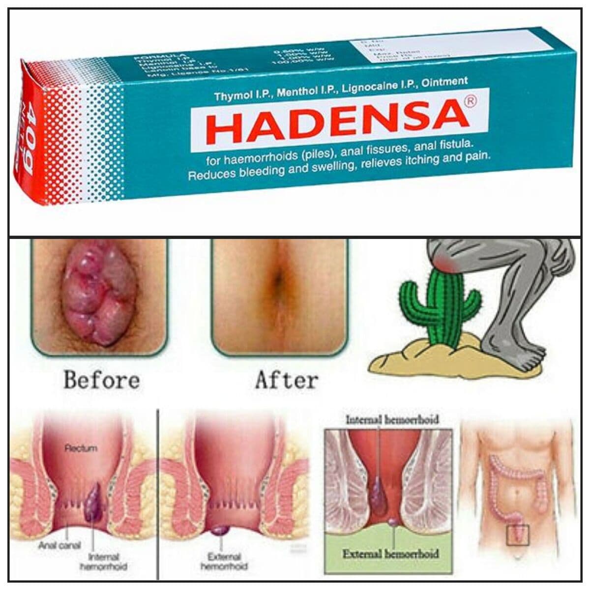 Indian Hadensa Ointment For Piles  Man & Women - 20gm