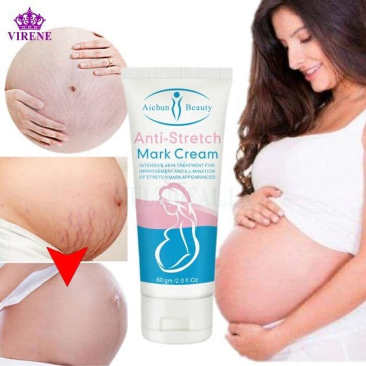 Anti Stretch Mark Cream 60 gm